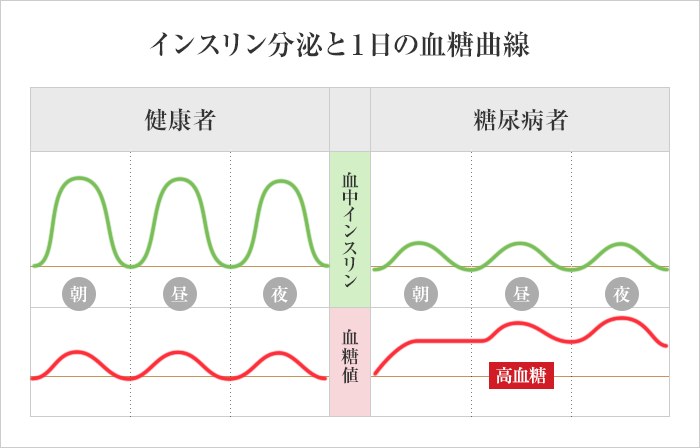 インスリン分泌と１日の血糖曲線